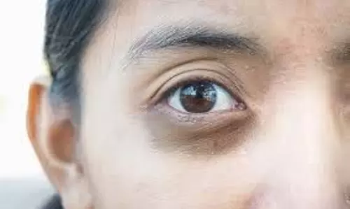 Skin Care: डार्क सर्कल्स से पाना है छुटकारा तो शहद में मिलाकर लगाएं ये चीजें Skin Care: डार्क सर्कल्स से पाना है छुटकारा तो शहद में मिलाकर लगाएं ये चीजें