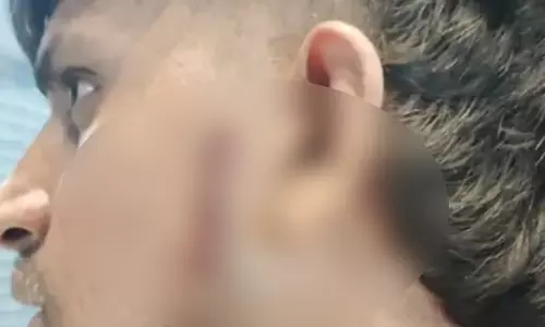 ड्राइवर को मारा चाकू, मोबाइल चोरी को लेकर उपजा विवाद