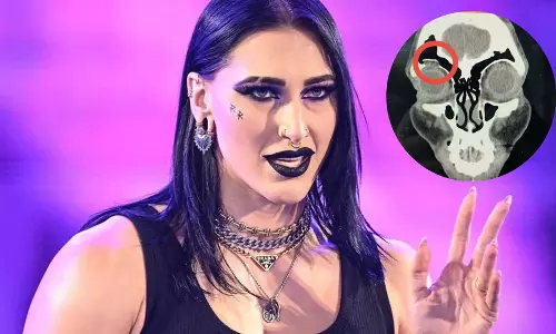 रिया रिप्ले WWE से अज्ञात समय के लिए बाहर, चेतावनी के साथ चोट की तस्वीर साझा की