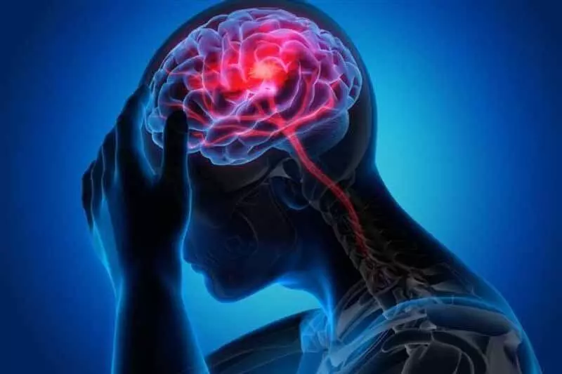 Brain Stroke विश्व स्तर पर नई महामारी के रूप में उभर रहा