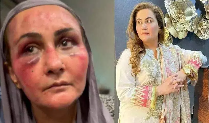 बंदूक से मारा गया और बाल पकड़कर घसीटा गया: says Pakistani actress