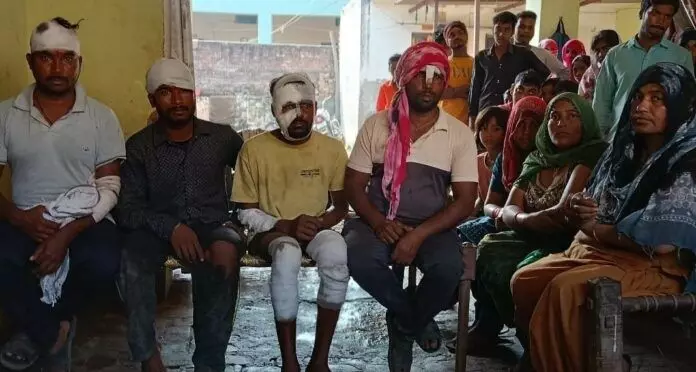 Muzaffarnagar: गोवर्धन पूजा के बाद पटाखे चलाने को लेकर विवाद में दर्जनों घायल हुए