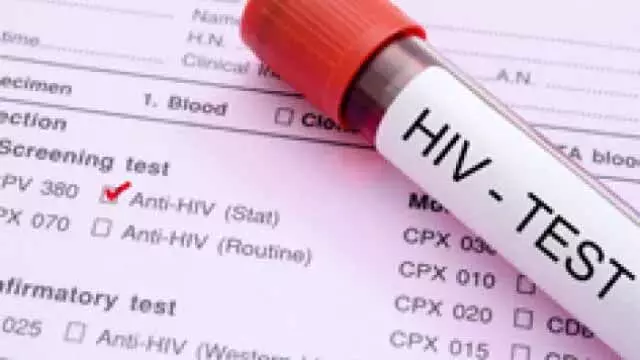 HIV की गलत रिपोर्ट, सिविल सर्जन को कलेक्टर ने थमाया नोटिस