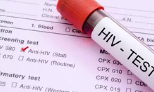 HIV की गलत रिपोर्ट, सिविल सर्जन को कलेक्टर ने थमाया नोटिस HIV की गलत रिपोर्ट, सिविल सर्जन को कलेक्टर ने थमाया नोटिस