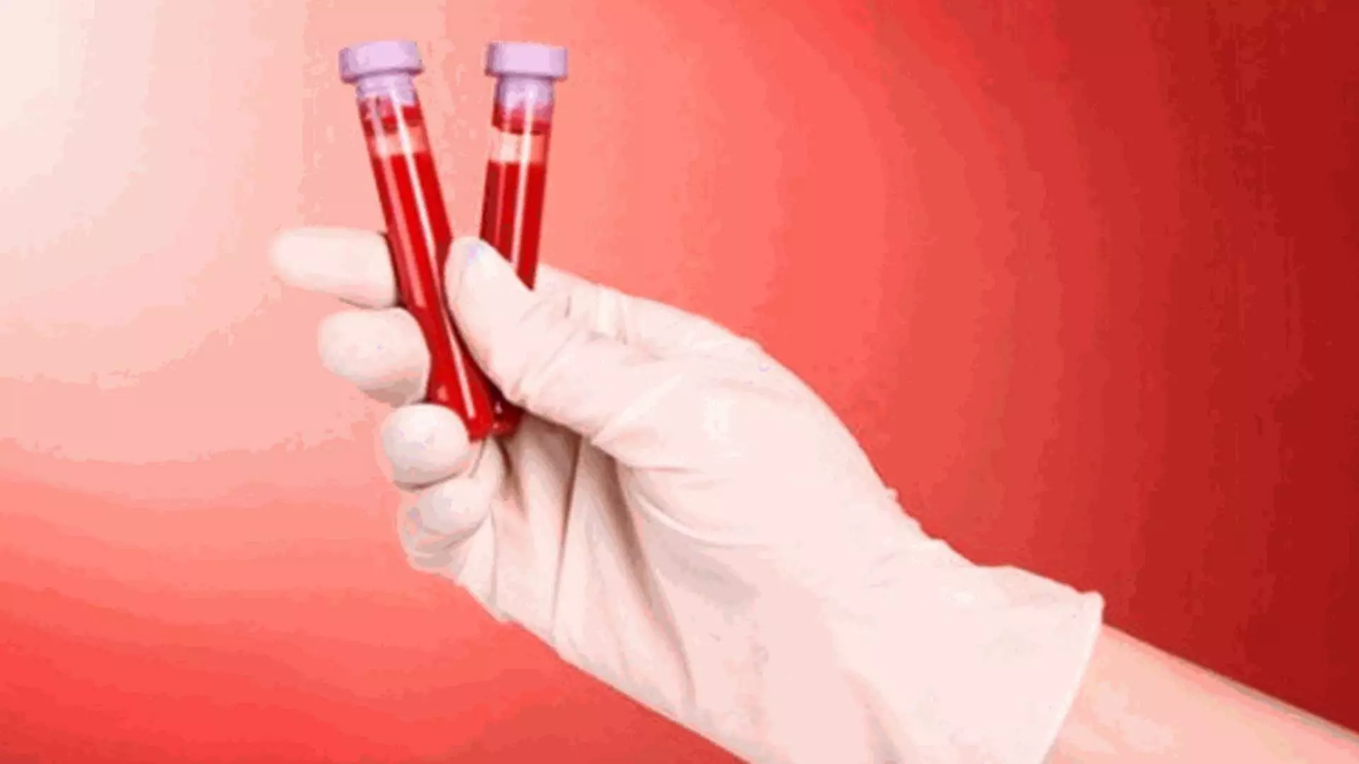 Blood-biomarker परीक्षण अल्जाइमर के शुरुआती निदान में सहायक हो सकते हैं- रिपोर्ट