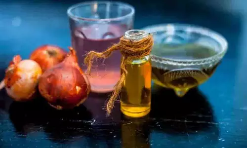 Hair Growth Remedy: प्याज के रस में ये 2 चीजें मिलाकर लगाएंगे तो उगने लगेंगे नए बाल Hair Growth Remedy: प्याज के रस में ये 2 चीजें मिलाकर लगाएंगे तो उगने लगेंगे नए बाल
