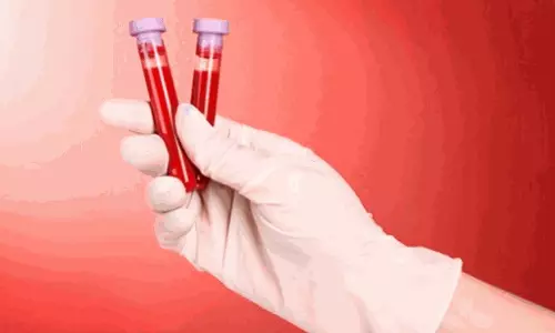 Blood-biomarker परीक्षण अल्जाइमर के शुरुआती निदान में सहायक हो सकते हैं- रिपोर्ट