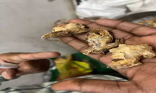 Hyderabad: मूसापेट और संतोष नगर के रेस्तराँ में ढीले मानक Hyderabad: मूसापेट और संतोष नगर के रेस्तराँ में ढीले मानक