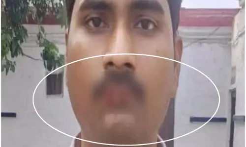 नशे में जीजा ने ये क्या कर डाला! साले का होंठ ही चबा डाला, दीदी के उड़े होश