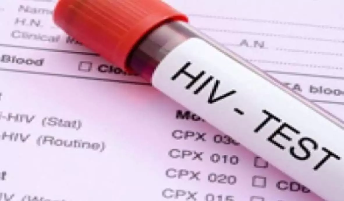 HIV के साढ़े तीन लाख टेस्ट का लक्ष्य