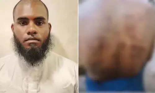 Kerala: छात्र को लोहे के बक्से से जलाने वाले मदरसा शिक्षक को गिरफ्तार Kerala: छात्र को लोहे के बक्से से जलाने वाले मदरसा शिक्षक को गिरफ्तार