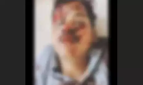 सामने से बाइक की टक्कर, युवक की मौत सामने से बाइक की टक्कर, युवक की मौत