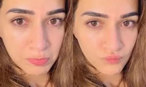 Kriti Sanon ने रोने वाले सीन के बाद अपनी आंखों की तस्वीरें शेयर कीं