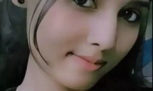लॉ स्टूडेंट डॉग अटैक में घायल, 15 टांके लगे लॉ स्टूडेंट डॉग अटैक में घायल, 15 टांके लगे