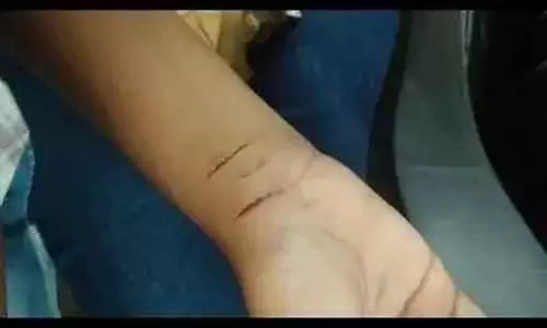 छात्रा को ब्लेड मारा, निकली थी स्कूल जाने