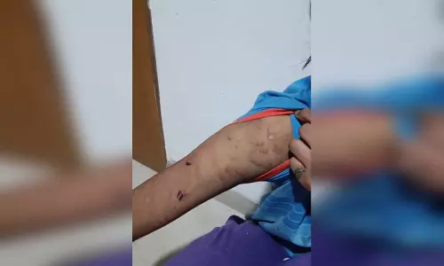 नाबालिग नौकरानी को पीटा, बच्ची को पुलिस ने कराया मुक्त, मुकदमा दर्ज नाबालिग नौकरानी को पीटा, बच्ची को पुलिस ने कराया मुक्त, मुकदमा दर्ज
