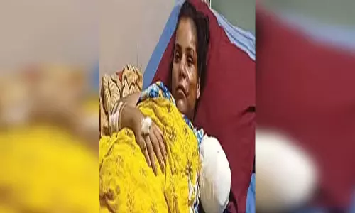 बाप रे: महिला का हाथ उखड़कर बाइक की चेन से ही लटका, बाइक पर बैठते समय सावधानी बरतें!