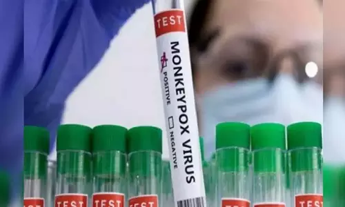Science: कौन से जानवर से आता है एमपॉक्स?