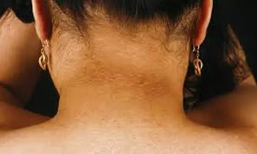 Lifestyle: गर्दन की टैनिंग से हो रहे है शर्मिंदा, फॉलो करें यह टिप्स