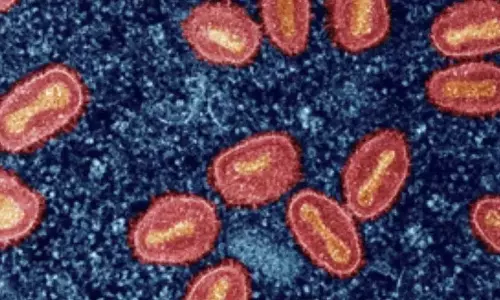 US ने कैलिफोर्निया में क्लेड Impox के पहले मामले की पुष्टि की