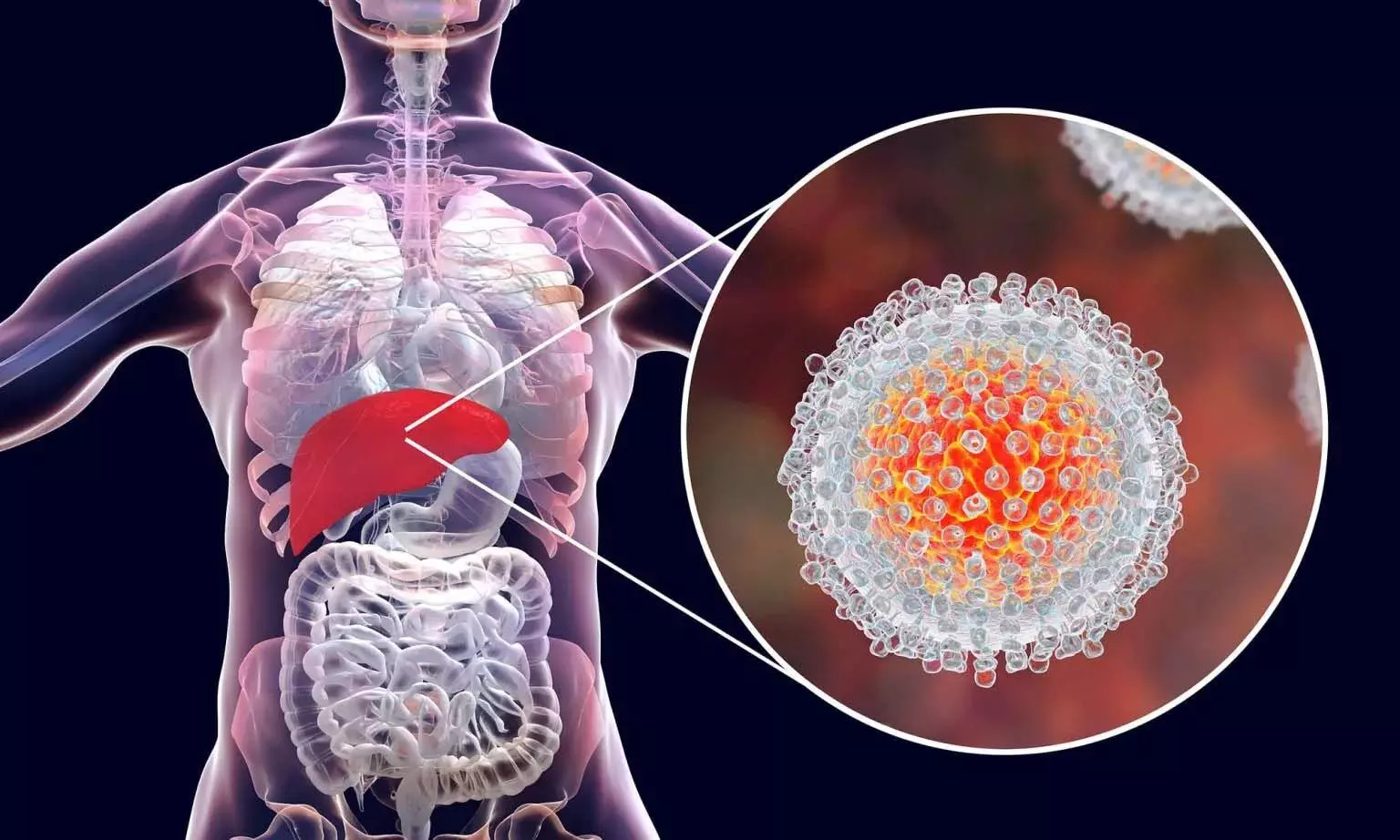 Hepatitis-A cases में वृद्धि के कारण बांदीपुरा में घर-घर सर्वेक्षण किया गया