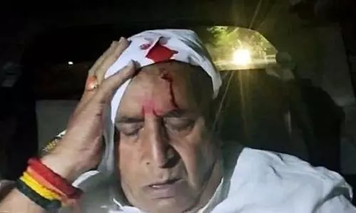 अनिल देशमुख ने कार के रूप में घायल किया है: BJP