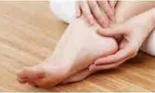 Cracked Heels: सर्दियों में फट जाती हैं एड़ियां, घरेलू टिप्स रखेंगे इनका ख्याल Cracked Heels: सर्दियों में फट जाती हैं एड़ियां, घरेलू टिप्स रखेंगे इनका ख्याल