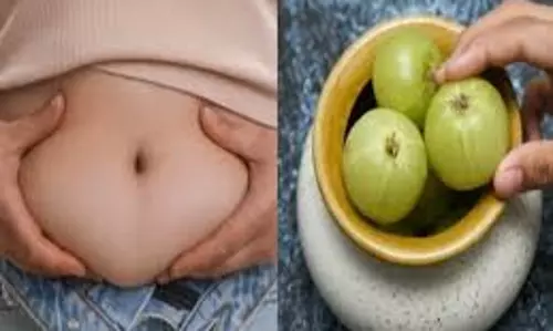Lifestyle: तेजी से घटाना है मोटापा, ऐसे करें आंवले का इस्तेमाल