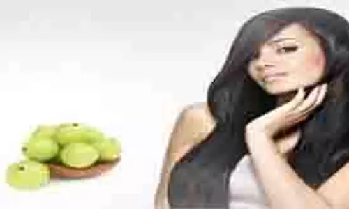 Hair Care: आंवला के साथ ये चीजें मिलाकर बालों पर लगाएं, झड़ने और रूसी से मिलेगी राहत Hair Care: आंवला के साथ ये चीजें मिलाकर बालों पर लगाएं, झड़ने और रूसी से मिलेगी राहत
