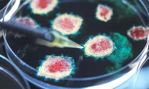 Science:क्या किसी संक्रामक रोग की मृत्यु दर 100% है?