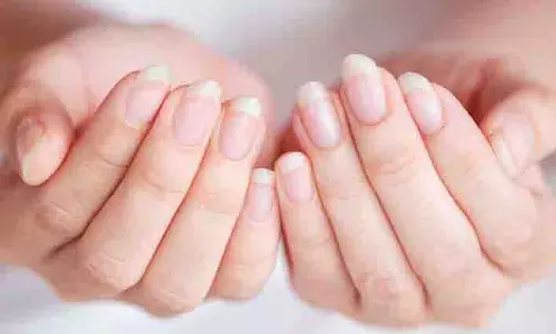 आप अपने नाखूनों को मजबूत बनाना चाहते हैं तो रोजाना ये उपाय आजमाएं