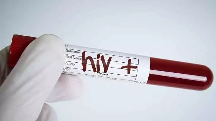 कर्नाटक में पिछले 10 सालों में HIV के मामलों में गिरावट देखी