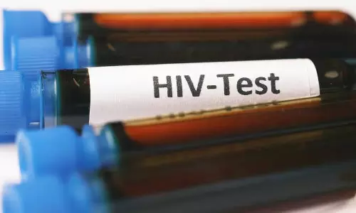 Assam में एचआईवी का प्रसार 0.13 प्रतिशत लेकिन बढ़ते संक्रमण