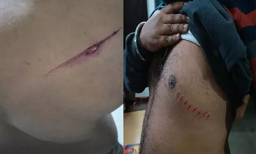 Raipur Breaking: कोटा में 2 युवकों पर जानलेवा हमला, केस दर्ज Raipur Breaking: कोटा में 2 युवकों पर जानलेवा हमला, केस दर्ज