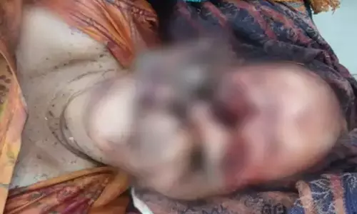 BREAKING: भालू ने महिला के चेहरे को खाया, लाश देखकर पुलिस हैरान