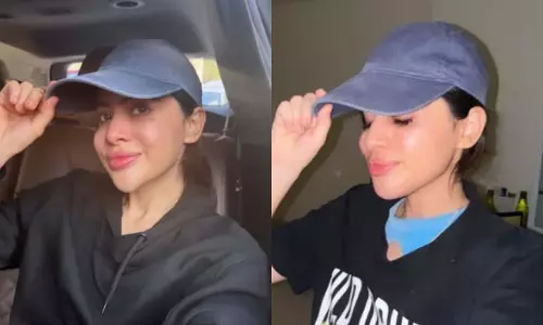 Uorfi Javed ने 9 साल बाद ठुड्डी से फिलर्स हटवाए Uorfi Javed ने 9 साल बाद ठुड्डी से फिलर्स हटवाए