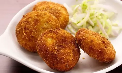 Dahi Kabab : स्वादिष्ट, सेहतमंद स्नैक्स Dahi Kabab : स्वादिष्ट, सेहतमंद स्नैक्स