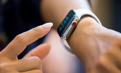बिलकुल फ्री में मिलेगी हाईटेक फीचर्स वाली Apple Watch