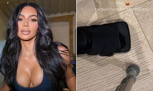 Kim Kardashian के पैर में गंभीर चोट, ले रही बैसाखी का सहारा