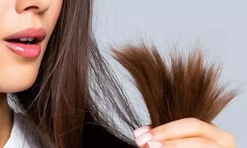 Hair Care: रूखे और झड़ते बालों से पाना हैं छुटकारा, जादुई तेल से करें मसाज Hair Care: रूखे और झड़ते बालों से पाना हैं छुटकारा, जादुई तेल से करें मसाज
