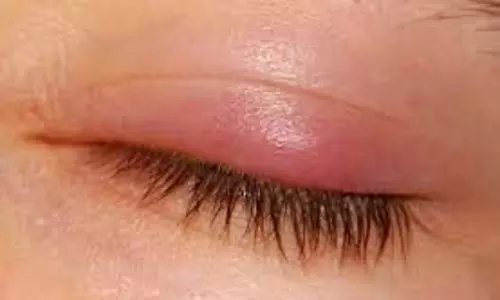 Haryana News: रास्ता देने को कहा तो किशोर ने फोड़ दी लड़के की आंख