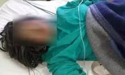 Jammu-Kashmir: शादी समारोह में खाना खाने के बाद हुआ कुछ ऐसा, जिसे देख हर कोई हैरान