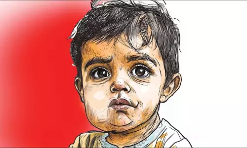 Mumps: 69,000 संक्रमित, इस वर्ष 30 गुना वृद्धि, स्वास्थ्य विभाग का कहना Mumps: 69,000 संक्रमित, इस वर्ष 30 गुना वृद्धि, स्वास्थ्य विभाग का कहना