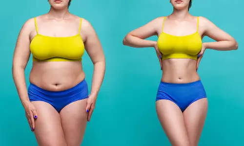 Lifestyle: मोटी महिलाओं के लिए यह है ख़ास एक्सरसाइज, तेजी से घटेगा बजन