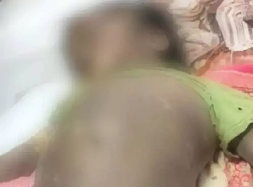 BREAKING: बोरवेल में गिरे मासूम की फ्रैक्चर से नहीं, डूबने से हुई मौत BREAKING: बोरवेल में गिरे मासूम की फ्रैक्चर से नहीं, डूबने से हुई मौत