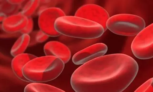 Anemia के निदान को बढ़ावा देने और फोरेंसिक जांच में सहायता के लिए नया अध्ययन