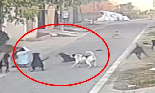 महिला पर कुत्तों ने किया जानलेवा हमला, 25 से ज्यादा जगहों पर काटा