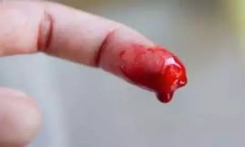 ये क्या! लड़के ने खुद काटी अपने हाथ की 4 उंगलियां, वजह जानकर लोग सकते में