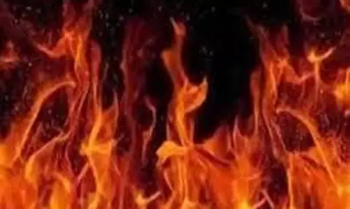 Up News: बड़े भाई ने छोटे भाइयों को कमरे में बंद कर आग लगा दी, पत्नी-बच्चे समेत पांच झुलसे Up News: बड़े भाई ने छोटे भाइयों को कमरे में बंद कर आग लगा दी, पत्नी-बच्चे समेत पांच झुलसे