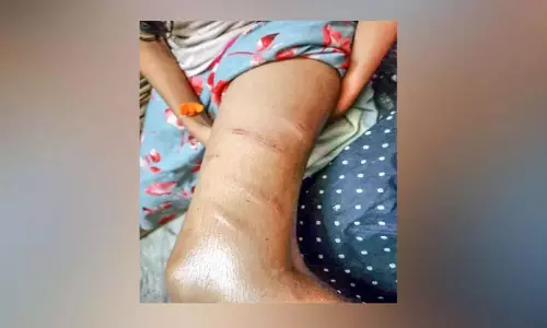 Kerala: ट्यूशन टीचर ने छठी कक्षा की छात्रा को बेरहमी से पीटा Kerala: ट्यूशन टीचर ने छठी कक्षा की छात्रा को बेरहमी से पीटा